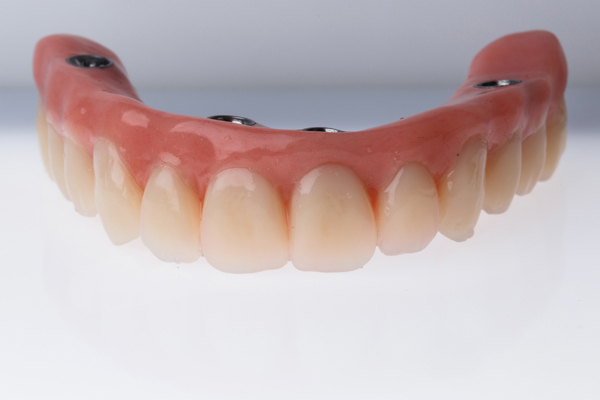 Benefits Of Dentures With All On   Implants