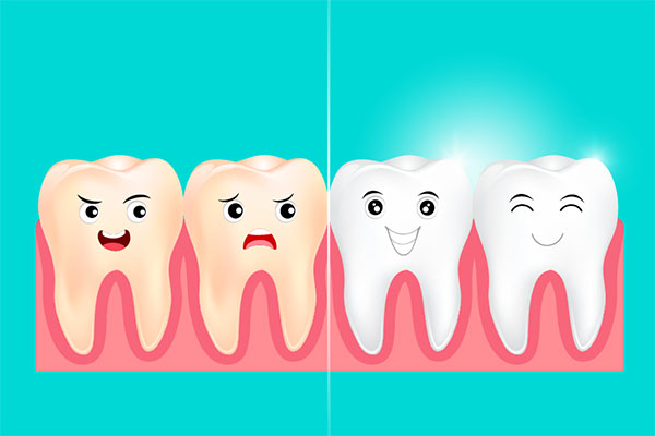 Why You Should Have A Bi Annual Dental Cleaning