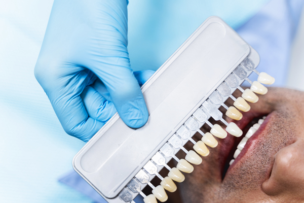 Cosmetic Dentistry Treatments To Improve The Appearance Of Your Teeth