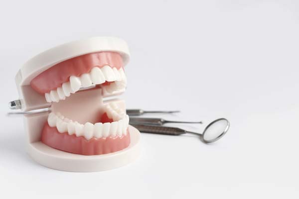 What Full Mouth Dental Implants Are