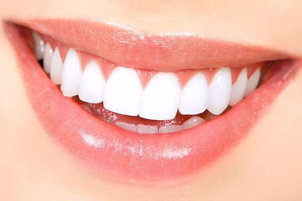 How Long Does Teeth Whitening Take from The Smile Spa in Agoura Hills, CA