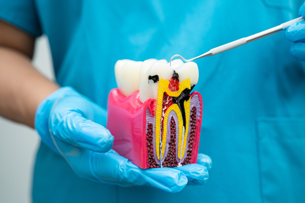 Root Canal Treatment: What To Expect And How It Saves Your Smile