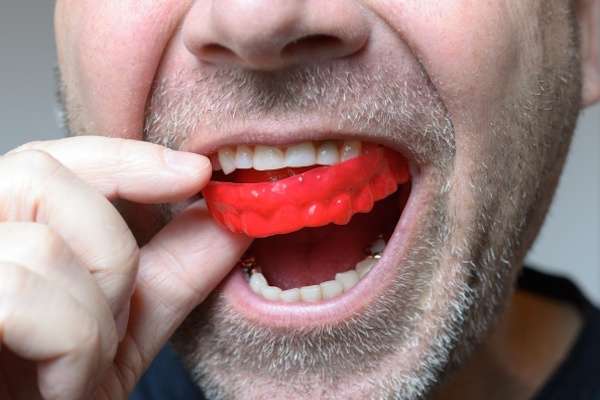 Save Your Teeth by Wearing Mouth Guards at Night from The Smile Spa in Agoura Hills, CA