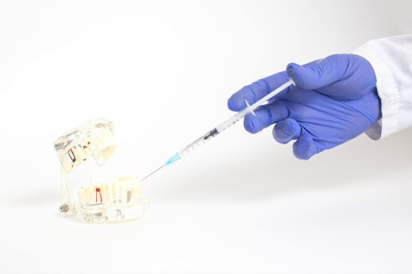 When Is IV Sedation Dentistry Recommended?